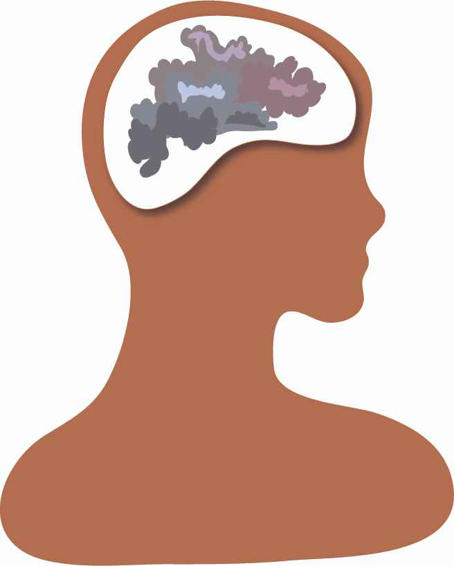 Brain fog by Susan Fluegel